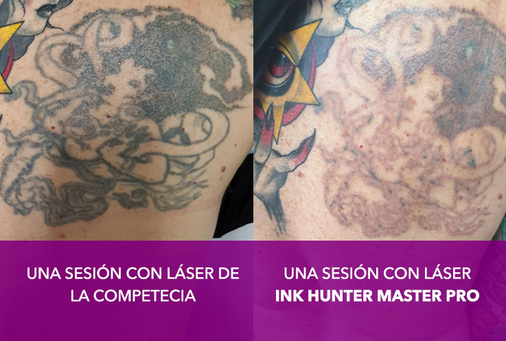 Diferencia entre láser de la competencia y INK HUNTER MASTER PRO