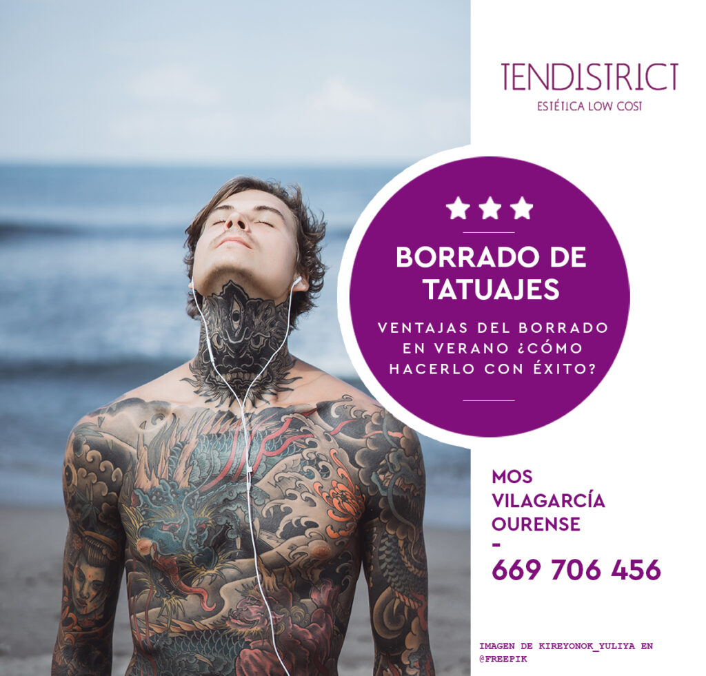 Ventajas de eliminar un tatuaje en verano